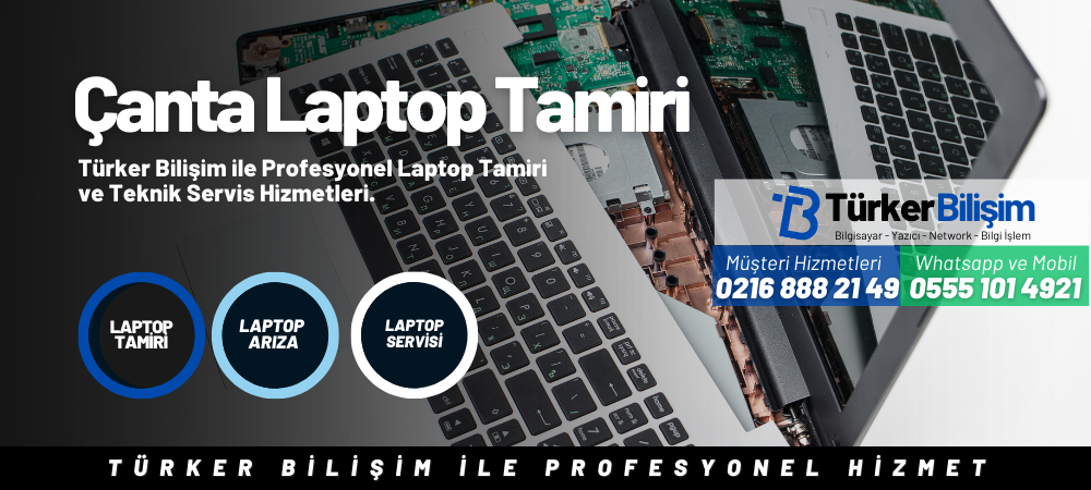 Çanta Gigabyte Laptop Tamiri